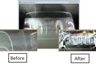 Video Enhancement Software